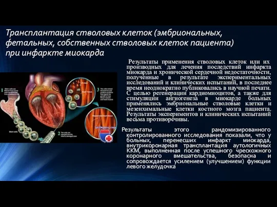 Трансплантация стволовых клеток (эмбриональных, фетальных, собственных стволовых клеток пациента) при