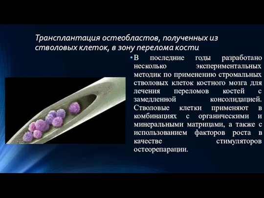 Трансплантация остеобластов, полученных из стволовых клеток, в зону перелома кости