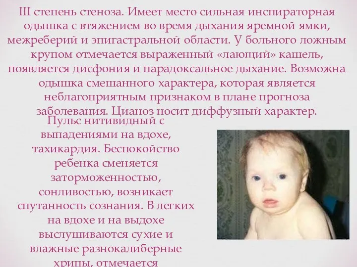 III степень стеноза. Имеет место сильная инспираторная одышка с втяжением