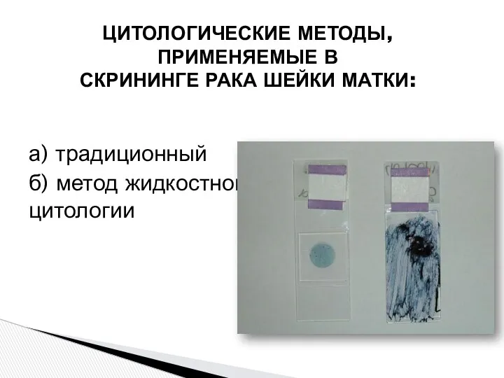 а) традиционный б) метод жидкостной цитологии ЦИТОЛОГИЧЕСКИЕ МЕТОДЫ, ПРИМЕНЯЕМЫЕ В СКРИНИНГЕ РАКА ШЕЙКИ МАТКИ: