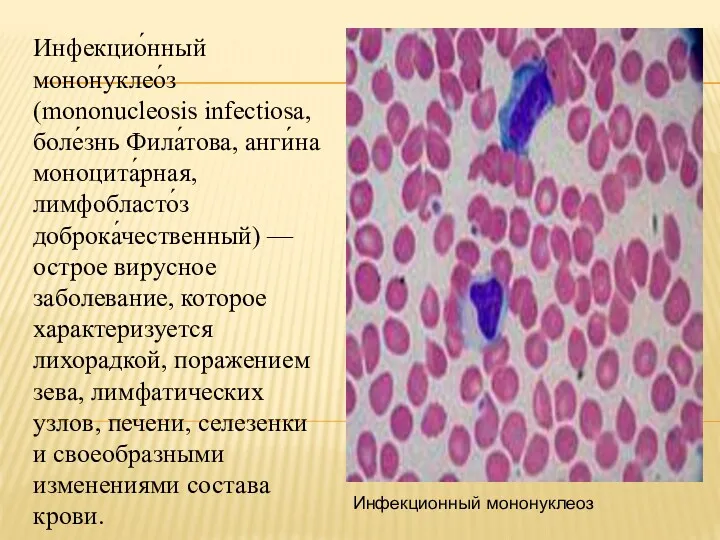 Инфекцио́нный мононуклео́з (mononucleosis infectiosa, боле́знь Фила́това, анги́на моноцита́рная, лимфобласто́з доброка́чественный) — острое вирусное