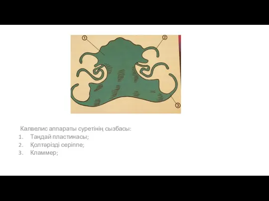 Калвелис аппараты суретінің сызбасы: Таңдай пластинасы; Қолтәрізді серіппе; Кламмер;