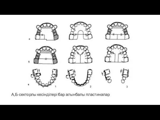 А,Б-секторлы кесінділері бар алынбалы пластиналар