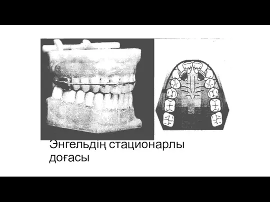 Энгельдің стационарлы доғасы