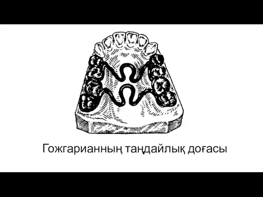 Гожгарианның таңдайлық доғасы