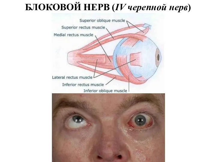 БЛОКОВОЙ НЕРВ (IV черепной нерв)