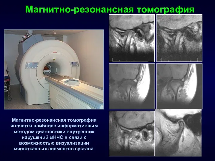 Магнитно-резонансная томография Магнитно-резонансная томография является наиболее информативным методом диагностики внутренних