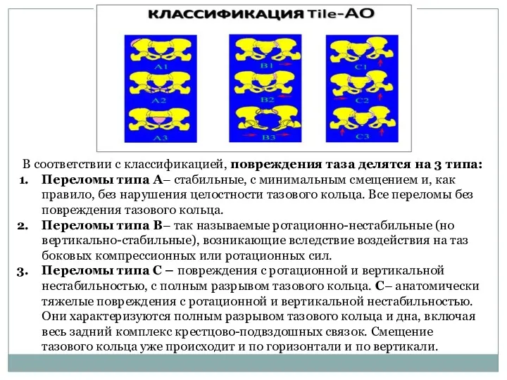 В соответствии с классификацией, повреждения таза делятся на 3 типа: Переломы типа А–