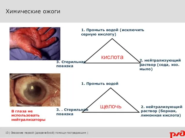 Химические ожоги 13| Оказание первой (доврачебной) помощи пострадавшим | кислота