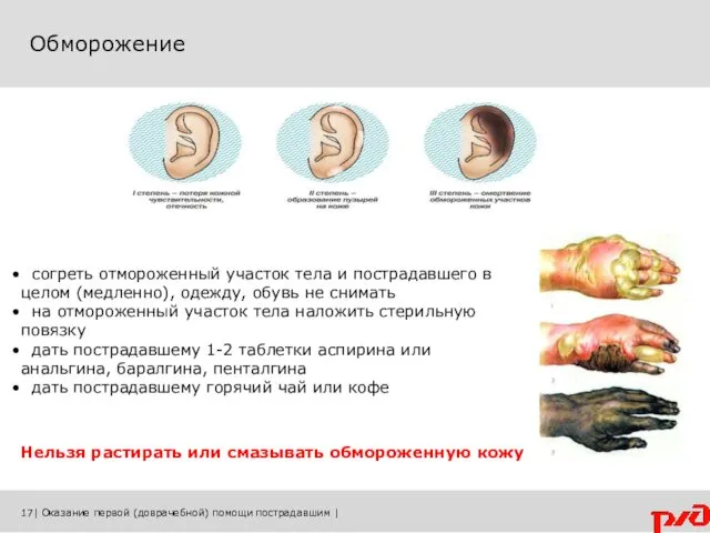 Обморожение 17| Оказание первой (доврачебной) помощи пострадавшим | согреть отмороженный