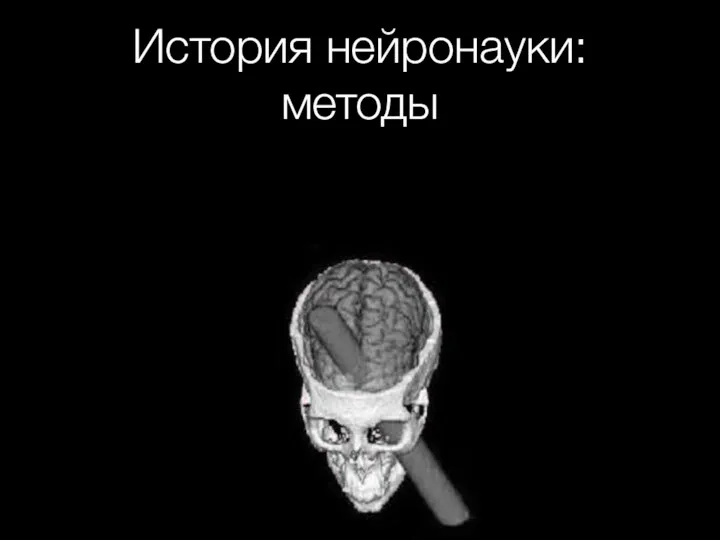 История нейронауки: методы Локальные повреждения в мозге