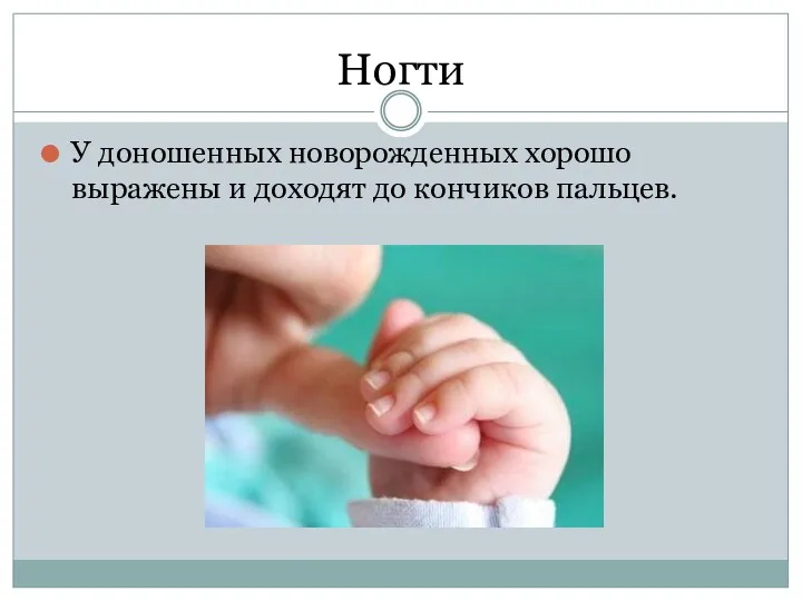 Ногти У доношенных новорожденных хорошо выражены и доходят до кончиков пальцев.