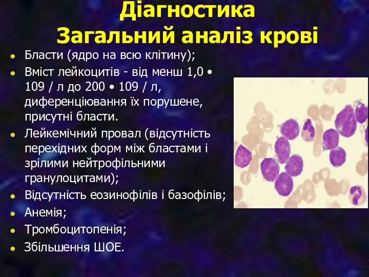 Діагностика Загальний аналіз крові Бласти (ядро на всю клітину); Вміст лейкоцитів - від