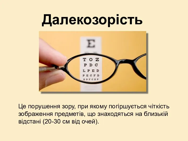 Далекозорість Це порушення зору, при якому погіршується чіткість зображення предметів,