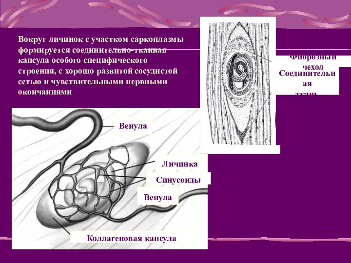 Венула Венула Личинка Коллагеновая капсула Синусоиды Фиброзный чехол Соединительная ткань