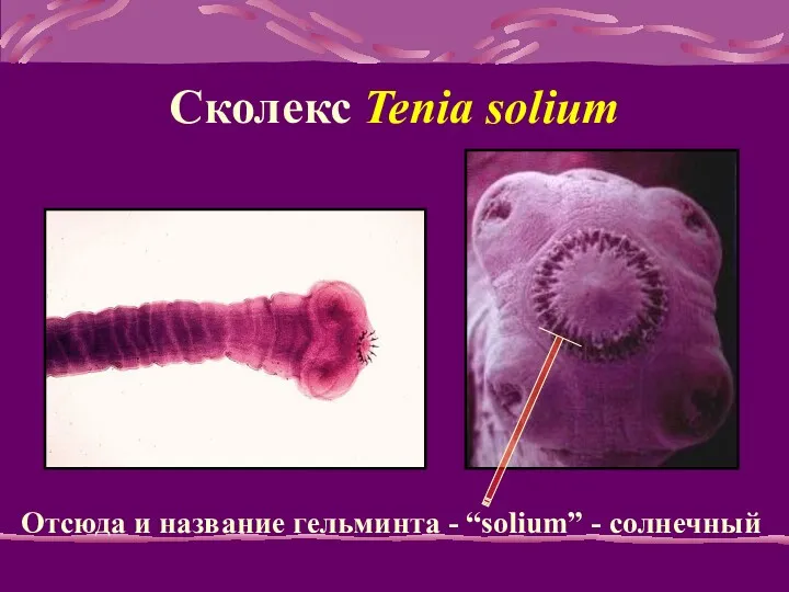 Сколекс Tenia solium Отсюда и название гельминта - “solium” - солнечный