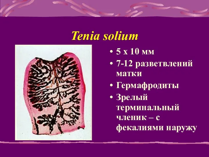 Tenia solium 5 x 10 мм 7-12 разветвлений матки Гермафродиты
