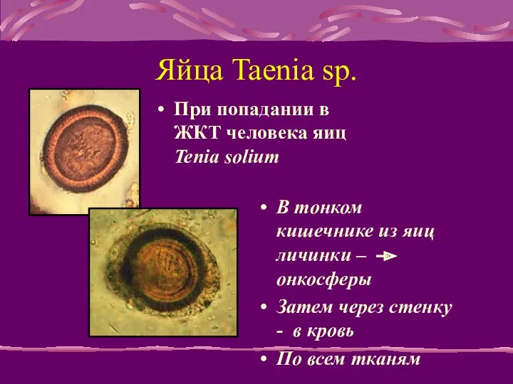 Яйца Taenia sp. При попадании в ЖКТ человека яиц Tenia