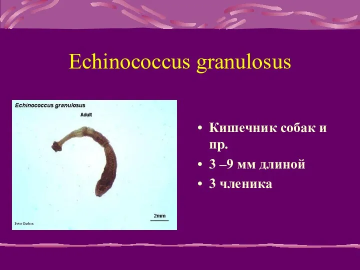 Echinococcus granulosus Кишечник собак и пр. 3 –9 мм длиной 3 членика