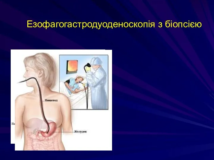 Езофагогастродуоденоскопія з біопсією