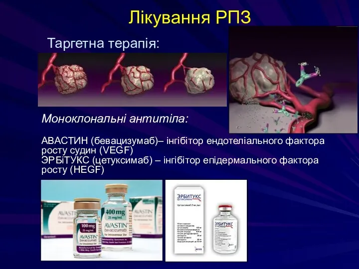 Лікування РПЗ Таргетна терапія: Моноклональні антитіла: АВАСТИН (бевацизумаб)– інгібітор ендотеліального