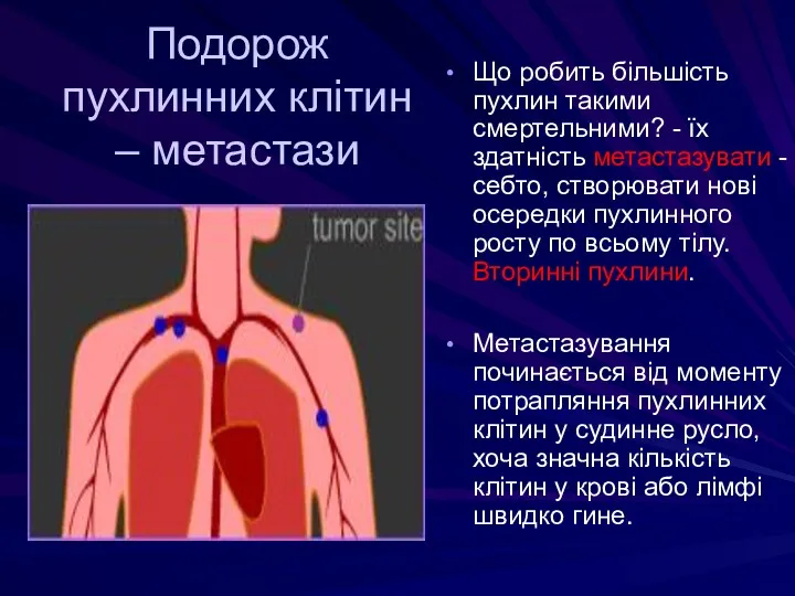 Подорож пухлинних клітин – метастази Що робить більшість пухлин такими