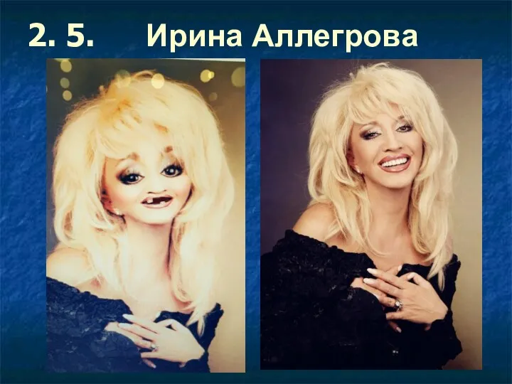 2. 5. Ирина Аллегрова