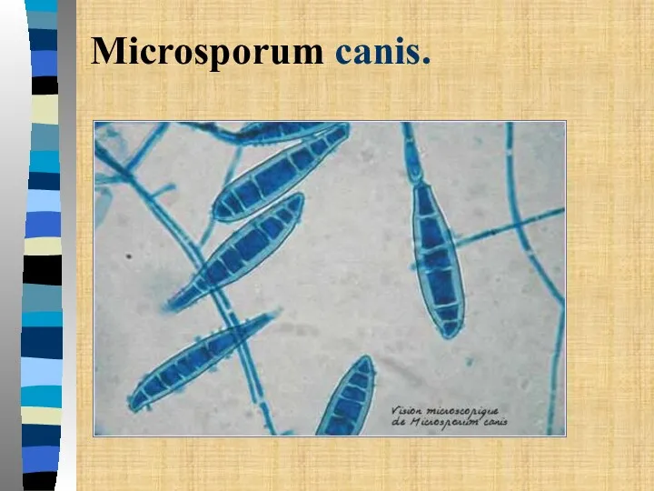 Microsporum canis.