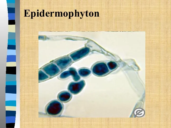 Epidermophyton