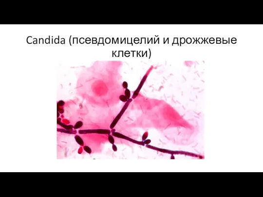 Candida (псевдомицелий и дрожжевые клетки)