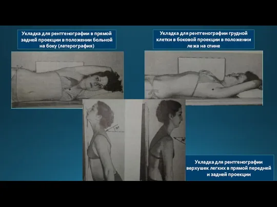 Укладка для рентгенографии в прямой задней проекции в положении больной на боку (латерография)