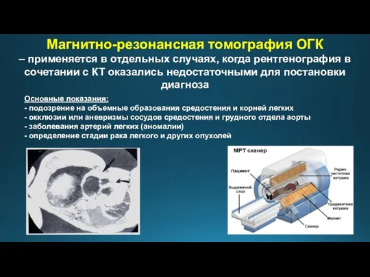 Магнитно-резонансная томография ОГК – применяется в отдельных случаях, когда рентгенография