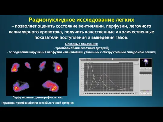 Радионуклидное исследование легких – позволяет оценить состояние вентиляции, перфузии, легочного