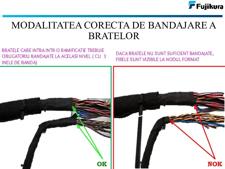 MODALITATEA CORECTA DE BANDAJARE A BRATELOR OK NOK BRATELE CARE