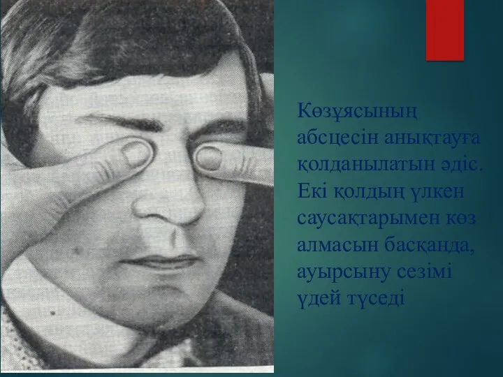 Көзұясының абсцесін анықтауға қолданылатын әдіс. Екі қолдың үлкен саусақтарымен көз алмасын басқанда, ауырсыну сезімі үдей түседі