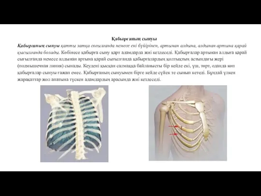 Қабырғаның сынуы Қабырғаның сынуы қатты затқа соғылғанда немесе екі бүйірінен, артынан алдына, алдынан