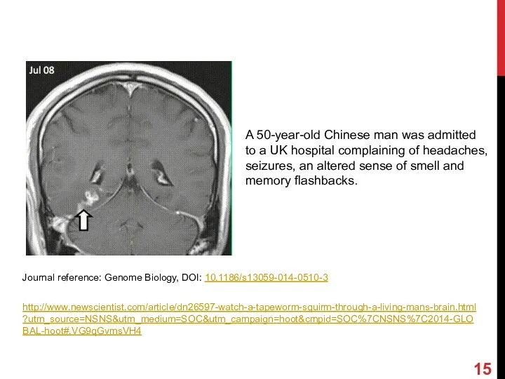 Journal reference: Genome Biology, DOI: 10.1186/s13059-014-0510-3 http://www.newscientist.com/article/dn26597-watch-a-tapeworm-squirm-through-a-living-mans-brain.html?utm_source=NSNS&utm_medium=SOC&utm_campaign=hoot&cmpid=SOC%7CNSNS%7C2014-GLOBAL-hoot#.VG9qGvmsVH4 A 50-year-old Chinese man was admitted