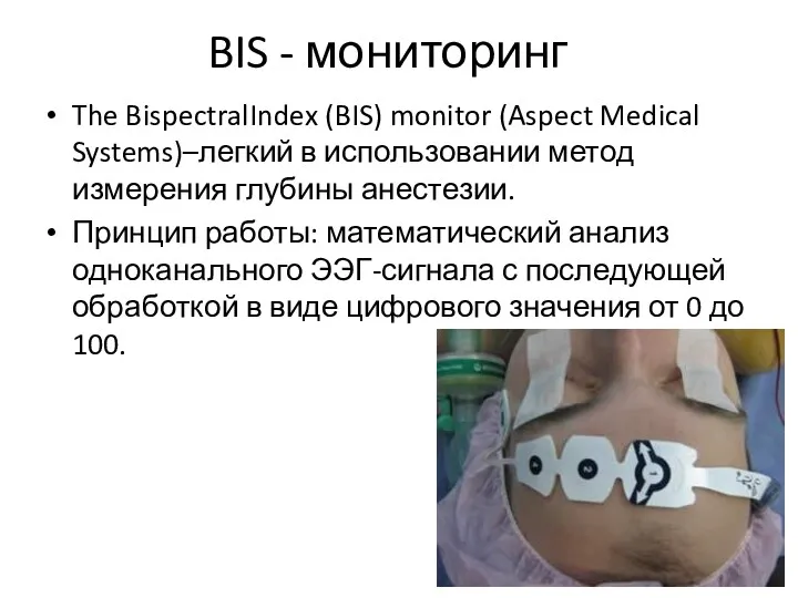 BIS - мониторинг The BispectralIndex (BIS) monitor (Aspect Medical Systems)–легкий в использовании метод