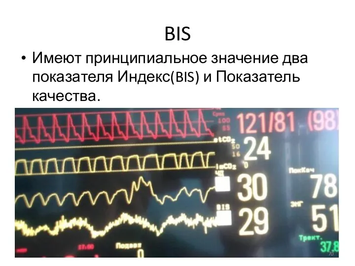 BIS Имеют принципиальное значение два показателя Индекс(BIS) и Показатель качества.