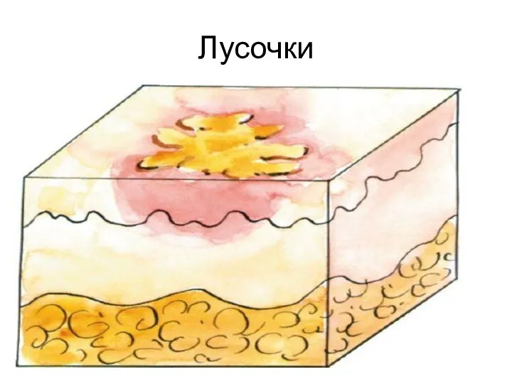 Лусочки