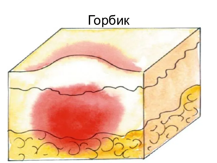 Горбик