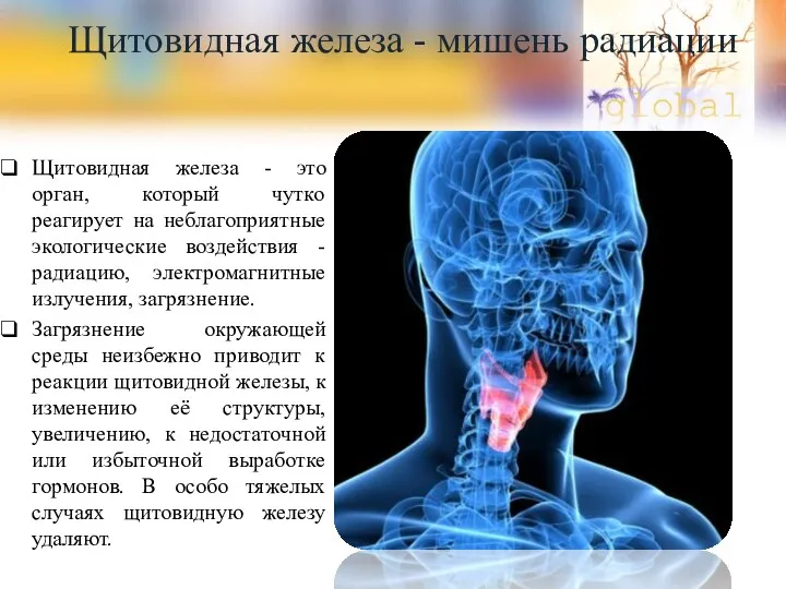 Щитовидная железа - мишень радиации Щитовидная железа - это орган, который чутко реагирует