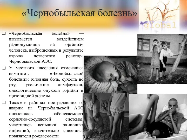 «Чернобыльская болезнь» «Чернобыльская болезнь» — вызывается воздействием радионуклидов на организм человека, выброшенных в