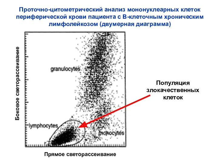 Проточно-цитометрический анализ мононуклеарных клеток периферической крови пациента с В-клеточным хроническим