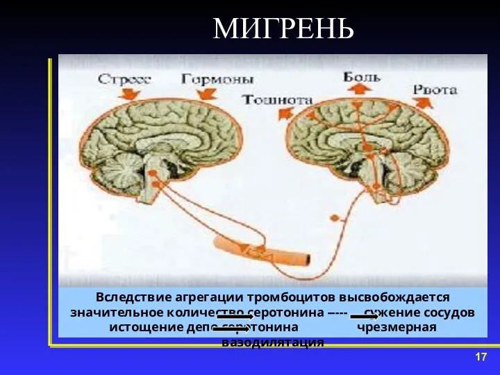 МИГРЕНЬ Вследствие агрегации тромбоцитов высвобождается значительное количество серотонина ----- сужение сосудов истощение депо серотонина чрезмерная вазодилятация