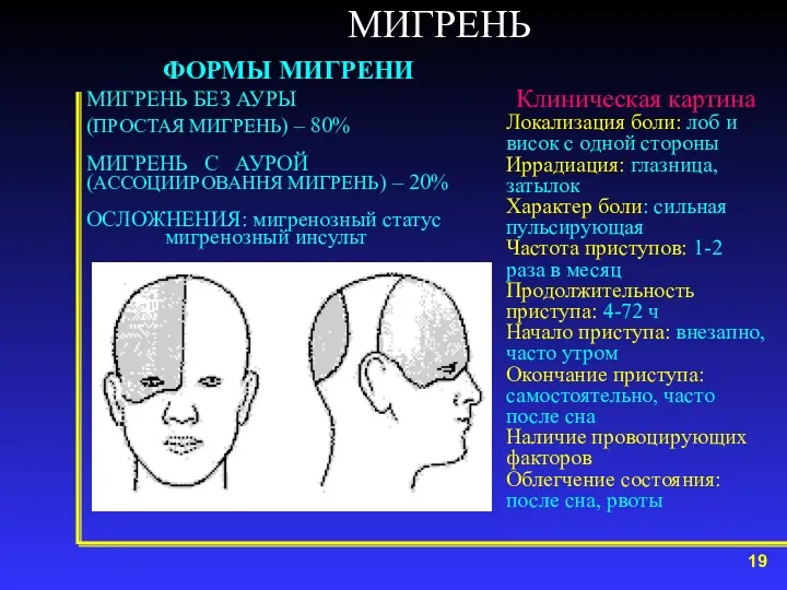 МИГРЕНЬ ФОРМЫ МИГРЕНИ МИГРЕНЬ БЕЗ АУРЫ (ПРОСТАЯ МИГРЕНЬ) – 80%