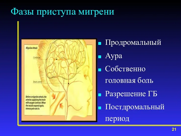 Фазы приступа мигрени Продромальный Аура Собственно головная боль Разрешение ГБ Постдромальный период