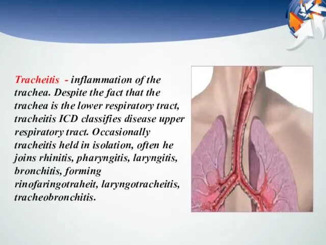 Tracheitis - inflammation of the trachea. Despite the fact that