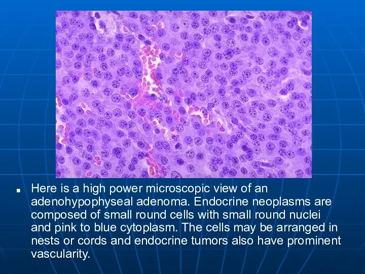 Here is a high power microscopic view of an adenohypophyseal