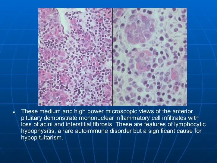 These medium and high power microscopic views of the anterior